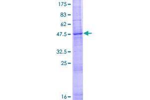 Image no. 1 for Solute Carrier Family 35 (UDP-GlcNAc/UDP-Glucose Transporter), Member D2 (SLC35D2) (AA 1-249) protein (GST tag) (ABIN1320393)