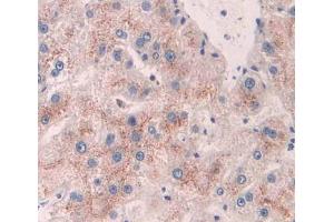 Used in DAB staining on fromalin fixed paraffin- embedded Kidney tissue