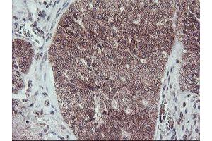 Image no. 11 for anti-Fragile X Mental Retardation 1 (FMR1) (AA 26-279) antibody (ABIN1491292)