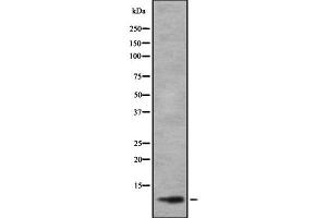 Western blot analysis of TAL2 using HuvEc whole cell lysates (TAL2 anticorps  (C-Term))