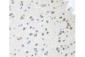 Immunohistochemistry of paraffin-embedded Rat brain using SAP18 Polyclonal Antibody at dilution of 1:100 (40x lens). (SAP18 anticorps)