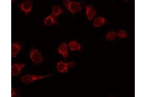 ABIN6276300 staining COLO205 by IF/ICC. (CD40 anticorps  (C-Term))