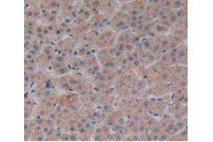 Detection of CRN in Human Liver Tissue using Polyclonal Antibody to Corin (CRN)