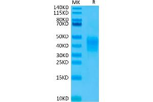 Biotinylated CD79B on Tris-Bis PAGE under reduced condition. (CD79b Protein (AA 29-159) (His-Avi Tag,Biotin))