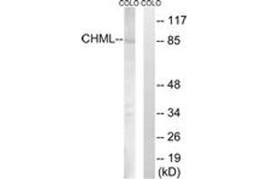 Western blot analysis of extracts from COLO cells, using CHML Antibody. (CHML anticorps  (AA 128-177))