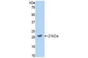 Western blot analysis of recombinant Mouse GAS6. (GAS6 anticorps  (AA 483-646))
