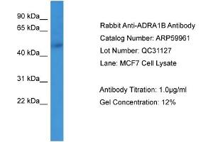 WB Suggested Anti-ADRA1B  Antibody Titration: 0. (ADRA1B anticorps  (N-Term))