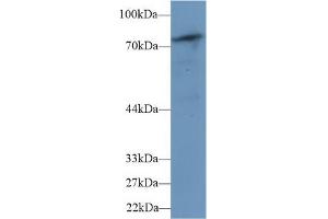 Detection of PLCd4 in Mouse Skeletal muscle lysate using Polyclonal Antibody to Phospholipase C Delta 4 (PLCd4) (PLCD4 anticorps  (AA 1-250))