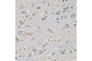 Immunohistochemistry of paraffin-embedded rat brain using FASTKD1 Antibody. (FASTKD1 anticorps  (AA 638-847))