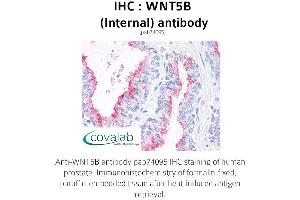 Image no. 1 for anti-Wingless-Type MMTV Integration Site Family, Member 5B (WNT5B) (Internal Region) antibody (ABIN1740831) (WNT5B anticorps  (Internal Region))
