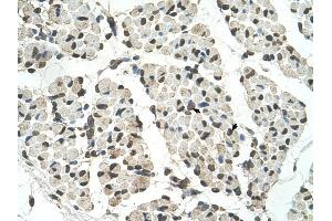 PSD3 antibody was used for immunohistochemistry at a concentration of 4-8 ug/ml to stain Skeletal muscle cells (arrows) in Human Muscle. (PSD3 anticorps  (Middle Region))