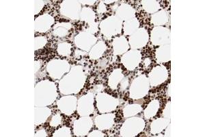 Immunohistochemical staining of human NFE2 polyclonal antibody  shows strong nuclear positivity in bone marrow poietic cells at 1:50-1:200 dilution. (NFE2 anticorps)
