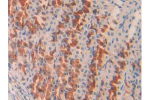 DAB staining on IHC-P; Samples: Rat Stomach Tissue (COL2A1 anticorps  (AA 1226-1331))