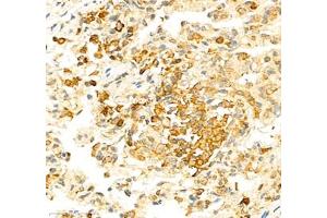 Immunohistochemistry of paraffin embedded rat lung using PTPN12 (ABIN7075292) at dilution of 1: 2500 (400x lens)
