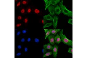 ABIN7094276 and ABIN7098323 staining Hela cells by IF/ICC. (Histone Cluster 1, H1t (HIST1H1T) (Internal Region) anticorps)