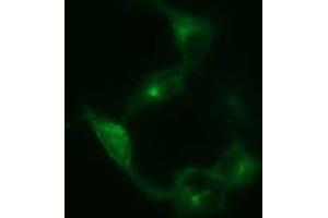 Image no. 1 for anti-Synaptophysin (SYP) antibody (ABIN1501255) (Synaptophysin anticorps)