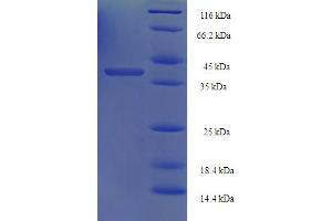 SDS-PAGE (SDS) image for RAD52 Homolog (S. Cerevisiae) (RAD52) (AA 60-282), (partial) protein (His-SUMO Tag) (ABIN5711075) (RAD52 Protein (AA 60-282, partial) (His-SUMO Tag))
