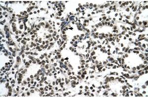 Human Lung; ZNF706 antibody - N-terminal region in Human Lung cells using Immunohistochemistry