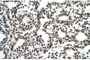Human Lung; ZNF706 antibody - N-terminal region in Human Lung cells using Immunohistochemistry (ZNF706 anticorps  (N-Term))