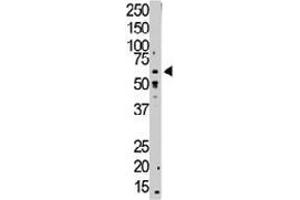 The TGFBR1 polyclonal antibody  is used in Western blot to detect TGFBR1 in mouse small intestine tissue lysate. (TGFBR1 anticorps  (Internal Region))