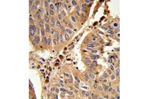 anti-Peroxisomal Biogenesis Factor 16 (PEX16) (AA 254-283), (Middle Region) antibody