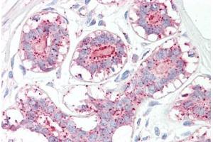 Image no. 2 for anti-Melanoma Antigen Family A, 1 (Directs Expression of Antigen MZ2-E) (MAGEA1) (AA 38-87) antibody (ABIN6749734)