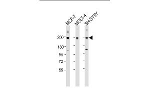 All lanes : Anti-CUX1 Antibody (C-term) at 1:2000 dilution Lane 1: MCF-7 whole cell lysate Lane 2: MOLT-4 whole cell lysate Lane 3: SH-SY5Y whole cell lysate Lysates/proteins at 20 μg per lane.