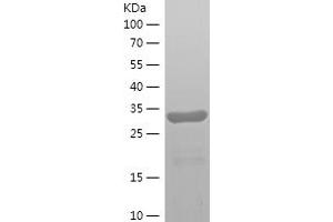 Western Blotting (WB) image for Semenogelin I (SEMG1) (AA 25-235) protein (His tag) (ABIN7125020)