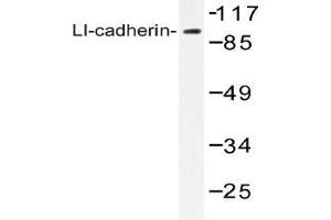 Western blot (WB) analysis of LI-cadherin antibody in extracts from Jurkat cells. (LI Cadherin anticorps)