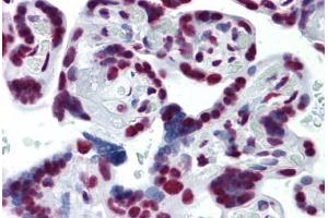 Human Placenta: Formalin-Fixed, Paraffin-Embedded (FFPE) (CDKL1 anticorps  (AA 259-358))