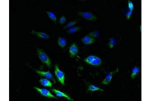 Immunofluorescent analysis of Hela cells using ABIN7172922 at dilution of 1:100 and Alexa Fluor 488-congugated AffiniPure Goat Anti-Rabbit IgG(H+L)