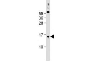 Western blot testing of human PC-3 cell lysate with SYNJBP antibody at 1:2000. (SYNJ2BP anticorps  (AA 22-66))