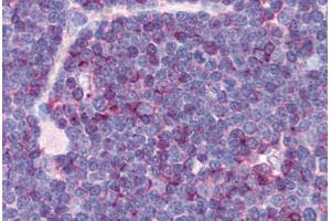 Human Thymus (formalin-fixed, paraffin-embedded) stained with CD99 antibody ABIN239808 at 10 ug/ml followed by biotinylated anti-mouse IgG secondary antibody ABIN481714, alkaline phosphatase-streptavidin and chromogen. (CD99 anticorps)