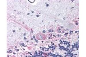 Immunohistochemistry (IHC) image for anti-Prostaglandin E Receptor 3 (Subtype EP3) (PTGER3) (3rd Cytoplasmic Domain) antibody (ABIN2469556)