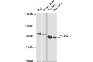 Western blot analysis of extracts of various cell lines, using KLC2 antibody (ABIN7268140) at 1:1000 dilution. (KLC2 anticorps  (AA 1-90))