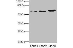 Western blot All lanes: ERVFRD-1 antibody at 3. (HERV-FRD Provirus Ancestral Env Polyprotein (Herv-frd) (AA 16-250) anticorps)