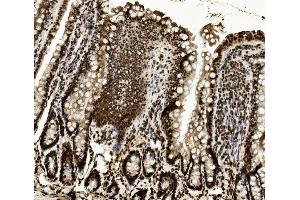 IHC analysis of DDX5 using anti-DDX5 antibody (ABIN7602561). (DDX5 anticorps  (AA 85-328))