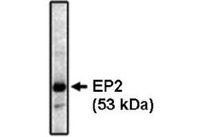 Western Blotting (WB) image for anti-Prostaglandin E Receptor 2 (Subtype EP2), 53kDa (PTGER2) antibody (ABIN264447) (PTGER2 anticorps)