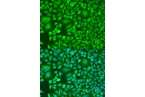 Immunofluorescence analysis of U2OS cells using RARB antibody (ABIN2737447) at dilution of 1:100.