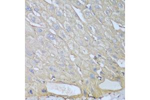 Immunohistochemistry of paraffin-embedded human liver using RPH3AL antibody at dilution of 1:100 (40x lens). (RPH3AL anticorps)