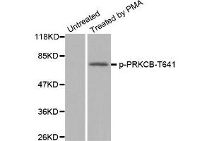 Western Blotting (WB) image for anti-Protein Kinase C, beta (PRKCB) (pThr641) antibody (ABIN1870521)