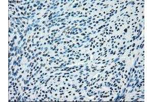 Immunohistochemical staining of paraffin-embedded pancreas tissue using anti-KDM4C mouse monoclonal antibody. (KDM4C anticorps)