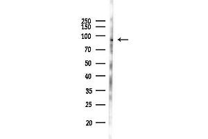 Western blot analysis of lysates from B16F10-LUC cells(heat-shock 45 min treatment), using Phospho-RSK1 p90 (Thr348) Antibody at 1/1000 dilution.