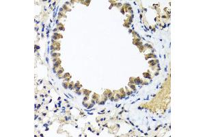 Immunohistochemistry of paraffin-embedded mouse lung using IFNL1 antibody at dilution of 1:100 (40x lens). (IL29 anticorps)