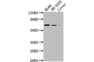 Western Blot Positive WB detected in: HL60 whole cell lysate, SH-SY5Y whole cell lysate, Mouse liver tissue All lanes: PTGS1 antibody at 1:2000 Secondary Goat polyclonal to rabbit IgG at 1/50000 dilution Predicted band size: 69, 65, 62, 57, 72, 73 kDa Observed band size: 72 kDa
