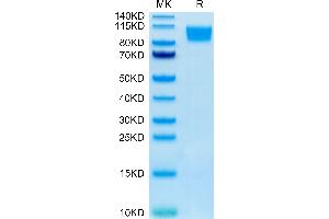 Human GUCY2C on Tris-Bis PAGE under reduced condition. (GUCY2C Protein (AA 24-430) (Fc Tag))