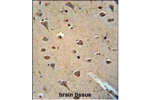 ALDH2 Monoclonal Antibody (ABIN658993 and ABIN2838036) immunohistochemistry analysis in formalin fixed and paraffin embedded human brain tissue followed by peroxidase conjμgation of the secondary antibody and DAB staining.