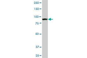 AMPD2 monoclonal antibody (M01), clone 2F5. (AMPD2 anticorps  (AA 86-185))