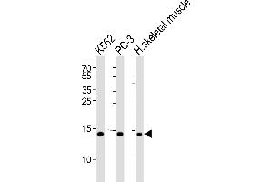 Western blot analysis of lysates from K562, PC-3 cell line and human skeletal muscle tissue lysate(from left to right), using HIST1H2BM Antibody (N-term) (ABIN6243575 and ABIN6577461). (HIST1H2BM anticorps  (N-Term))