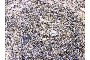 IHC testing of FFPE rat spleen with BIK antibody. (BIK anticorps  (AA 1-123))